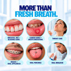 River Refresh Hypochlorous Acid Oral Mouthwash promotional graphic with the headline 'MORE THAN FRESH BREATH.' above six circular lifestyle photos showing oral health benefits: brightened teeth, mouth sores healed, throat care, braces and oral appliances, oral piercings, and an oral irrigator.